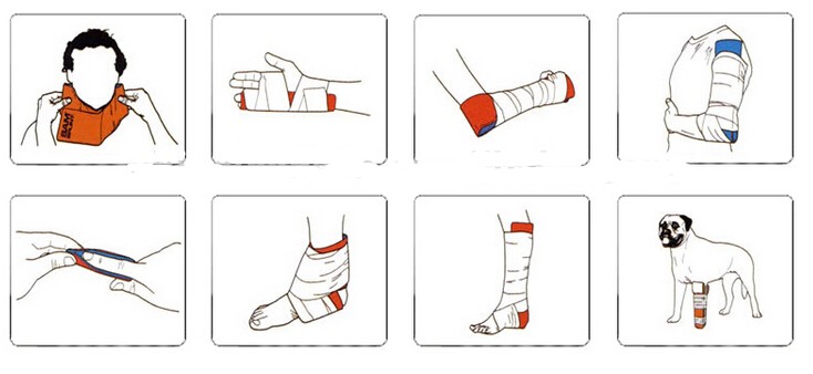 splint diagram